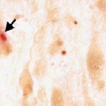 alzhiemer-sample543 Protein reversed memory loss in Alzheimer’s mice